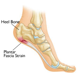 Plantar fascia pain relief and exercises
