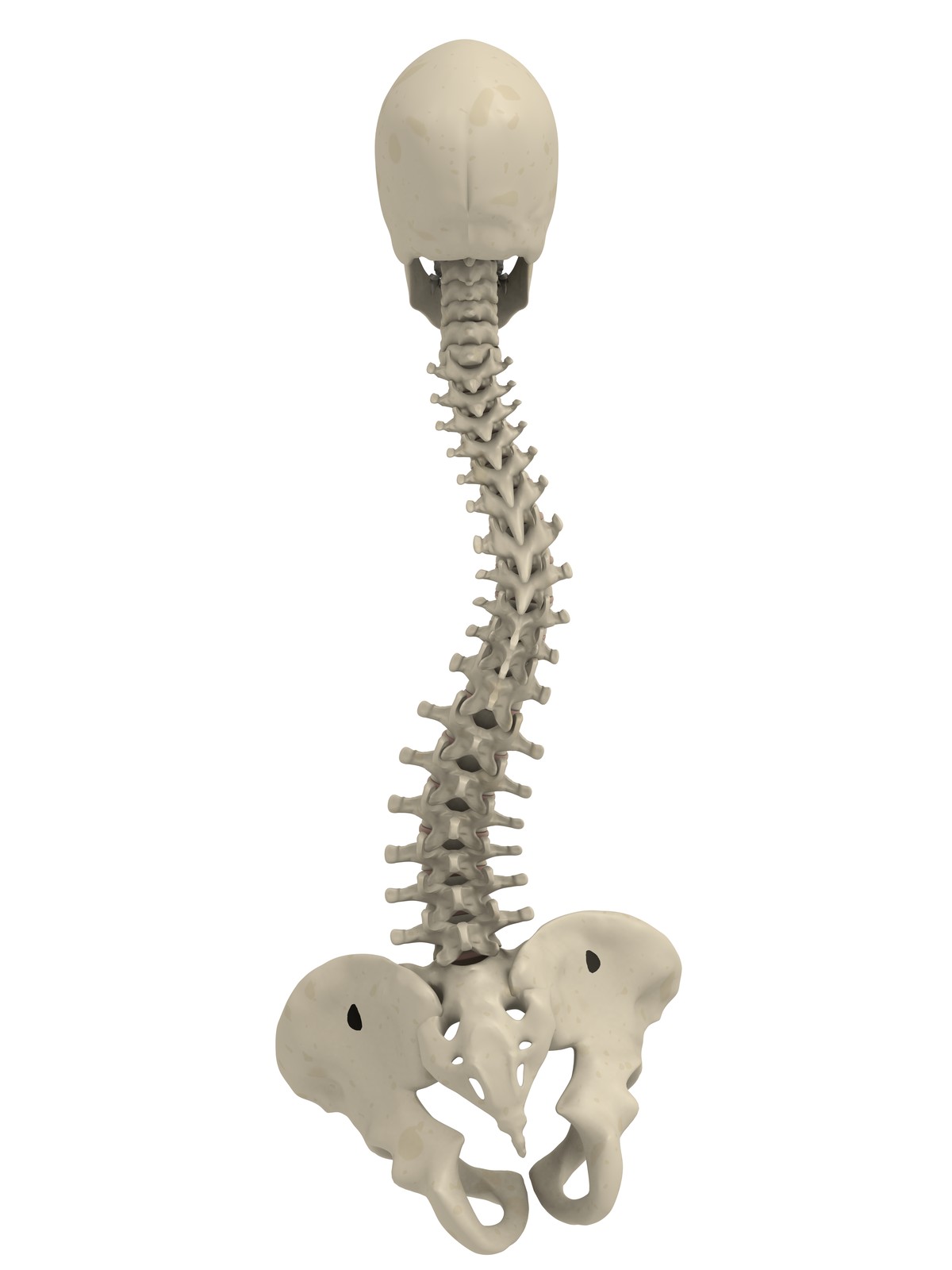 Understanding and treating scoliosis